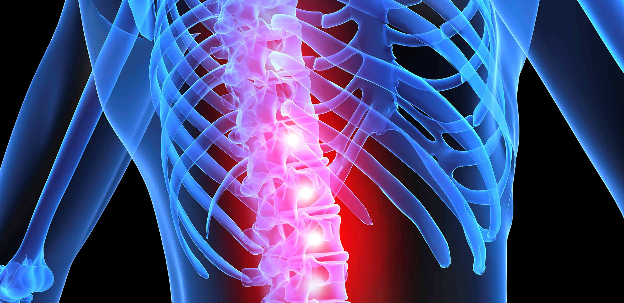 Graphic of skeleton and representation of Spine pain